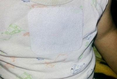 Пластырь на одежде ребенка