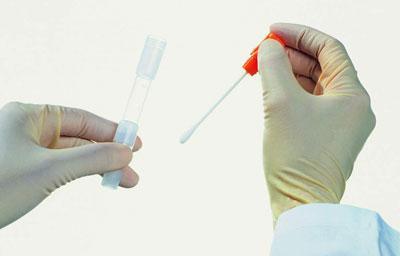 Пробирка для бакпосева