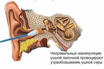 Причина образования серной пробки
