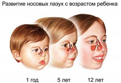 Развитие носовых пазух ребенка