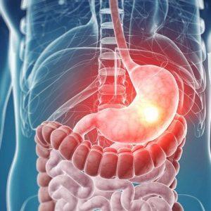 Патологии желудка