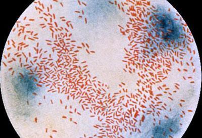 Гемофильная палочка