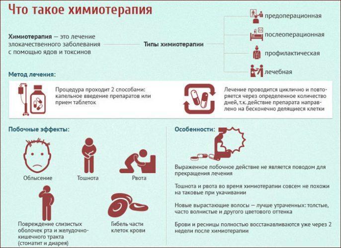 Как проводится химиотерапия