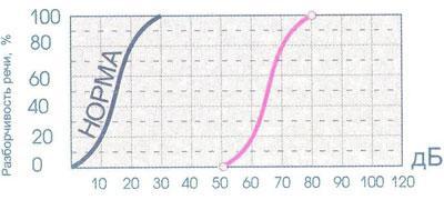 Шкала определения уровня слуха