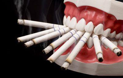 Злоупотребление курением