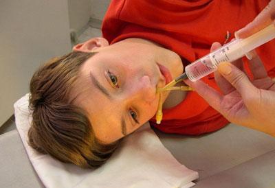 Промывание носа