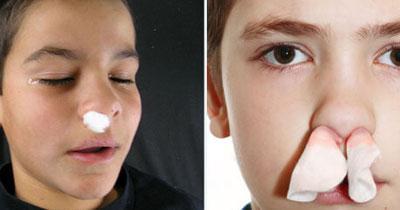 Турунды с лекарством