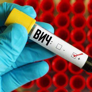 ВИЧ
